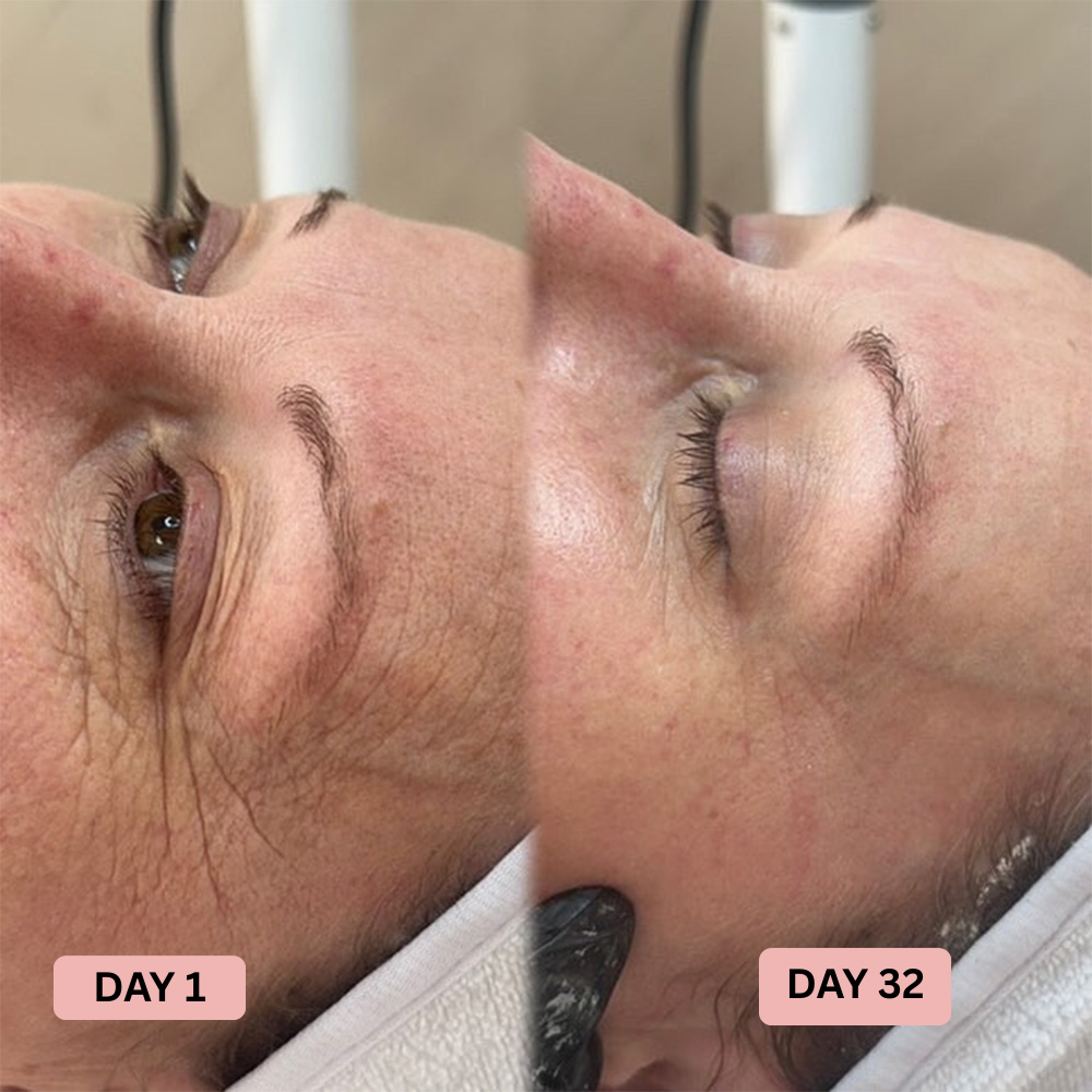 Korean Silk Peptide Lifting Ampoule